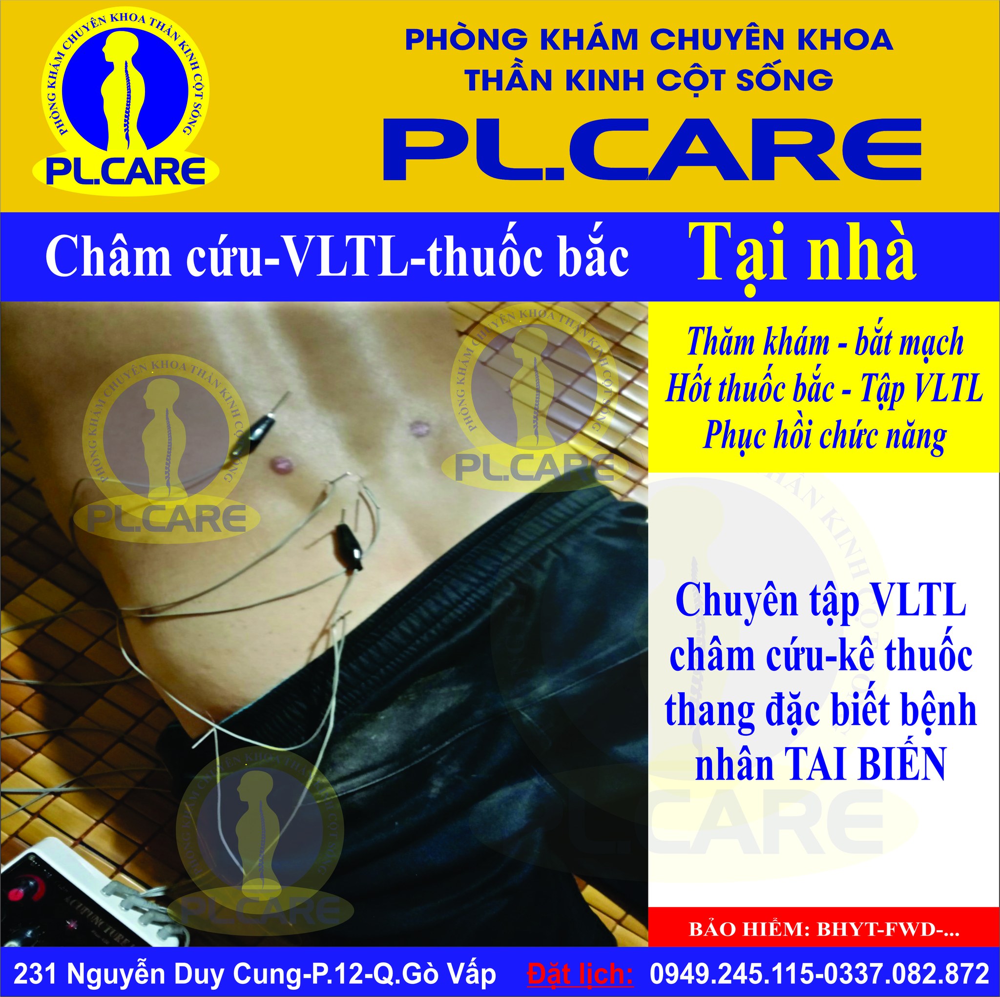 Châm cứu - Vật Lí Trị Liệu